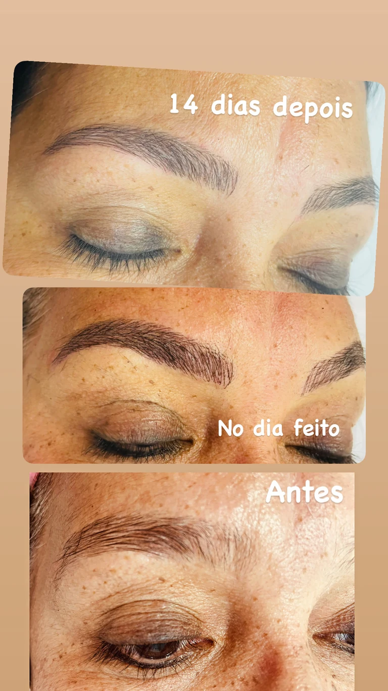 Comparativo antes e depois do procedimento de micropigmentação fio a fio em cliente atendida por Gi Gonzatto