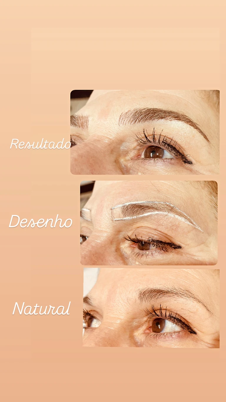 Resultado natural com desenho personalizado mostrado em diferentes ângulos